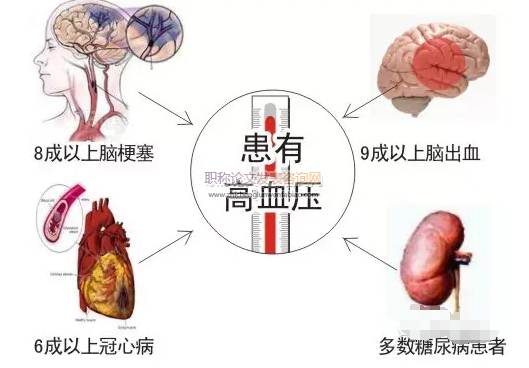 腦得生丸聯(lián)合降壓藥對高血壓眩暈的影響分析